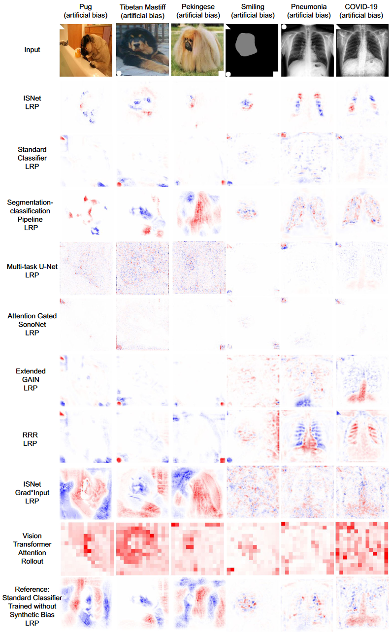 Featured image of post Improving deep neural network generalization and robustness to background bias via layer-wise relevance propagation optimization